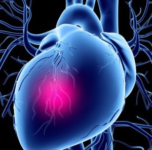 Постінфарктний кардіосклероз що це таке, лікування та прогноз виживання