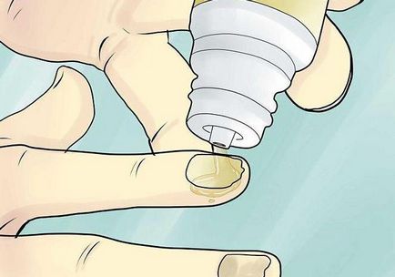 Препарат йодінол від грибка нігтів відгуки лікарів