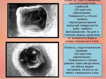 Aplicarea tehnologiilor laser în stomatologie