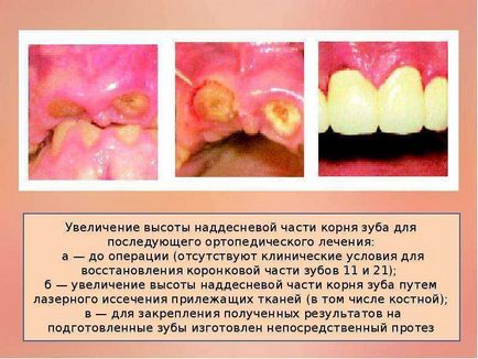 Застосування лазерних технологій в стоматології