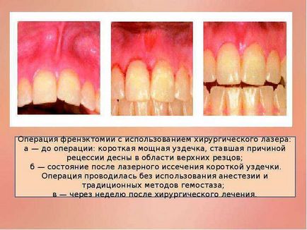 Aplicarea tehnologiilor laser în stomatologie