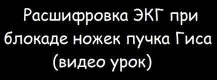 Ознаки повної блокади лівої ніжки пучка Гіса (ПНПГ) на ЕКГ