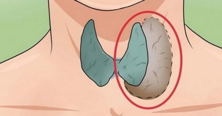 Probleme tiroidiene 7 ale semnalelor pe care le trimite organismul nostru
