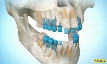 Progresul dinților dentare poate fi crescut la orice vârstă (2 fotografii)