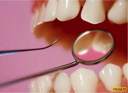 Progresul dinților dentare poate fi crescut la orice vârstă (2 fotografii)