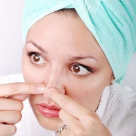 Простудні прищі на обличчі - причини, як позбутися, як позбутися від прищів, засіб від прищів