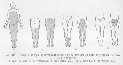 Розрив спинного мозку, чи можна стати на ноги, наслідки та відновлення