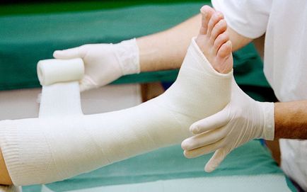 Rehabilitáció után eltört a lába gyógytorna, masszázs
