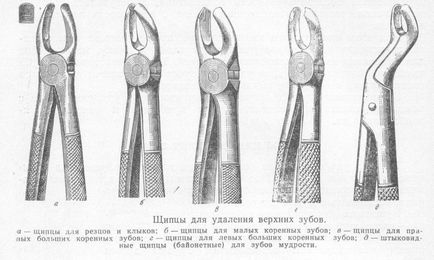 Щипці для видалення зубів види, огляд інструментів