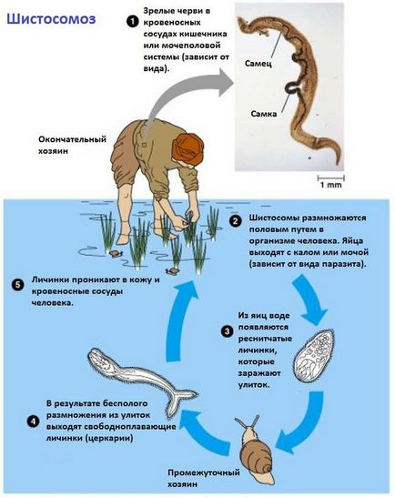 Schistosomiasis simptome și tratament la om