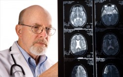 Simptomele și tratamentul accidentului vascular cerebral
