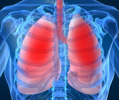 Simptomele pneumoniei și semnele altor pneumonii