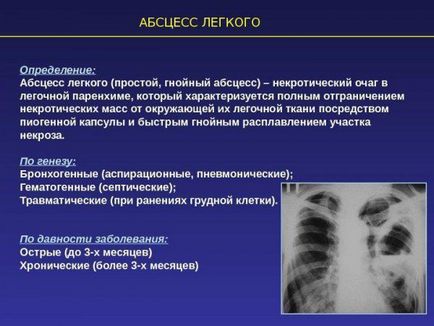 A tünetek a tüdőgyulladás tünetei tüdőgyulladás serdülők 14 és 15 éves, a terápia