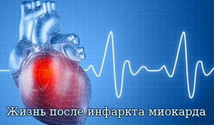 Hány ember évekig élhetnek a szívroham után - a szépség minden nyelven - Egészségügyi információk