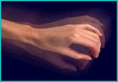 Tratamentul modern al tremuratului mâinii