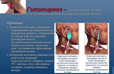 Temperatura și umflarea corpului cu hipotiroidism