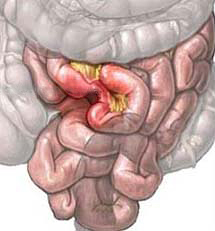 Intestine subțire