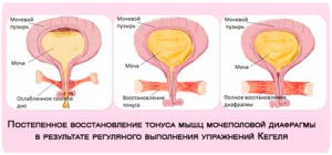 Exerciții de întărire a vezicii urinare la femei și bărbați - vii sănătoși