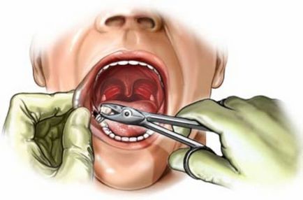 Servicii de stomatologie chirurgicală din clinică - dentă