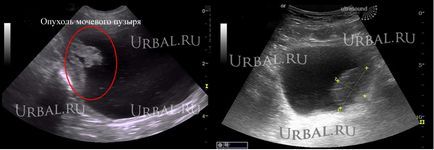 Diagnosticul Uzi al simptomelor cancerului, cauzele tumorilor, pregătirea, ce arată și cum