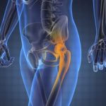 Ultrahang diagnosztika a tünetek a rák, az oka a tumorok, a készítmény, amely megmutatja, hogy hogyan és (ok) Ultrahang diagnosztika a tünetek a rák, az oka a daganatok, a készítmény, amely megmutatja, hogyan és