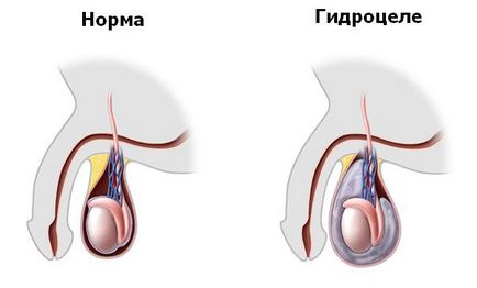 Urotul scrot