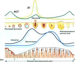 Problema modului in care endometrita afecteaza ciclul menstrual