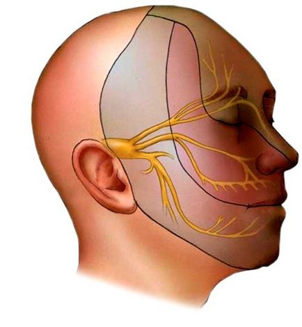 Inflamația simptomelor nervului trigeminal