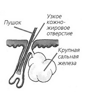 Жирне волосся