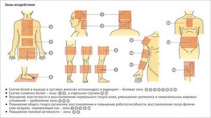 Аплікатор Кузнєцова при остеохондрозі шийного відділу