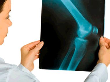 Artroscopia articulației genunchiului și operativ