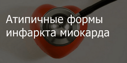 Forme atipice ale infarctului miocardic, simptome