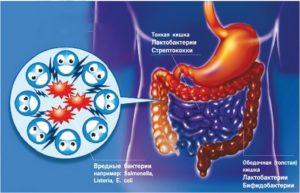 Dieta pentru disbioză intestinală la adulți