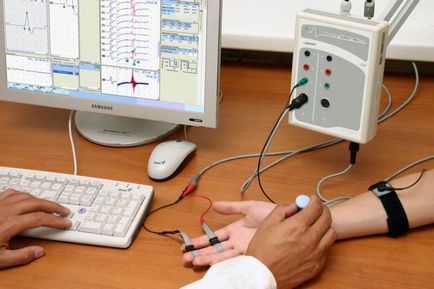 Electromiografia extremităților inferioare și superioare (emg) - prețul exploatației în Moscova