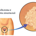 Gardasil instrucțiuni de utilizare, prețuri, recenzii și analogi