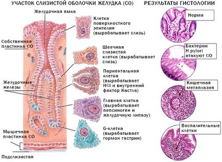 Histologie (morfologie) - examinarea probelor obținute ca rezultat al biopsiei esofagului, stomacului