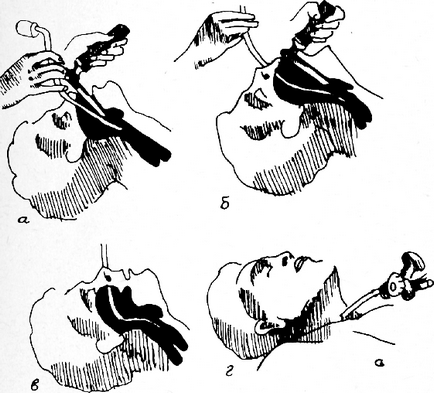 intubálnak