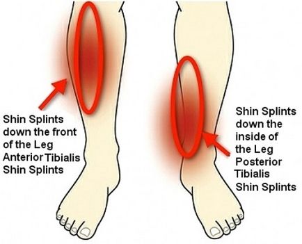 Як позбавиться від болю в ногах