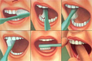 Hogyan, mikor, hogyan és miért kell fogat mosni
