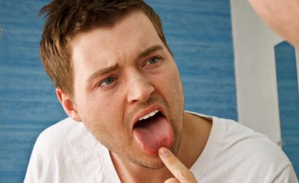 Cum poate o substanță chimică să ardă limba, vitaportal - sănătatea și medicina