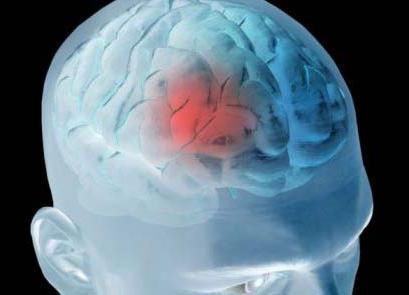 Cum să identificați o tulburare a simptomelor circulației cerebrale, tratamentul