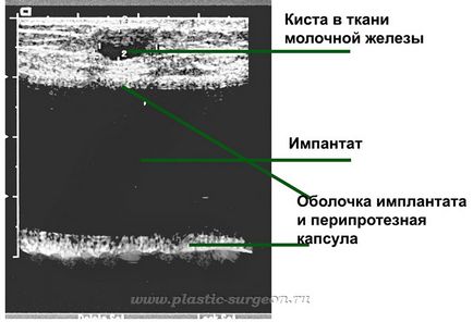 Clinica - artmeda - uzi de san cu implanturi