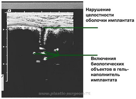 Clinica - artmeda - uzi de san cu implanturi