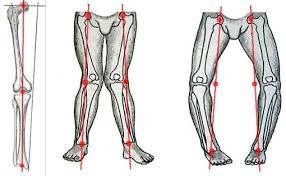 Artroza genunchiului Cauze, simptome, tratament