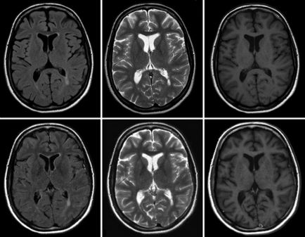 Tomografia computerizată a capului și a creierului în diguri de chei, tatklinik