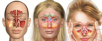 Коричневі соплі з носа у дорослих і дітей, медичний сайт