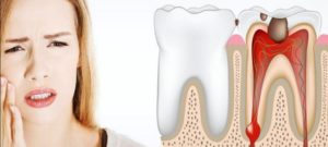 Tratamentul și îndepărtarea dinților în timpul alăptării cu anestezie