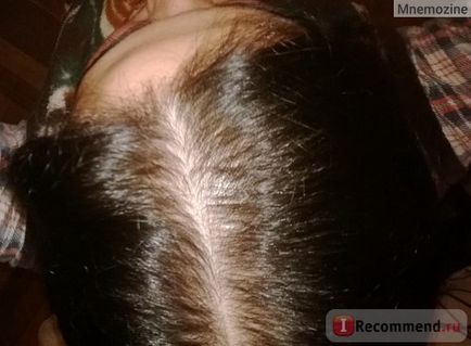 Mezoterápia haj és a fejbőr - „veszteség megállt érezhető növekedése - frissítés” vásárlói vélemények
