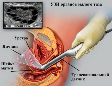 Чи можна робити узі при місячних для обстеження яєчників, сечового міхура, черевної порожнини, грудей