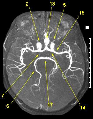 MRI az agy Naberezhnye Chelny, Avicena